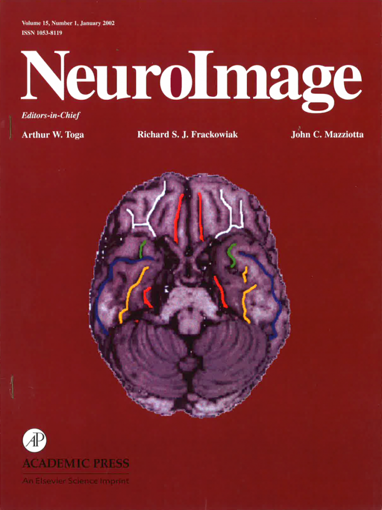 History – Neurofunctional Imaging Group (GIN-IMN)